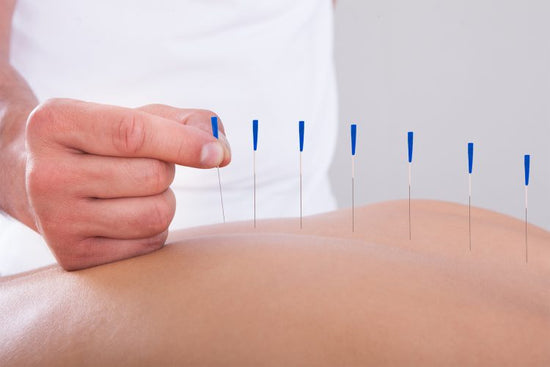 Bath Acupuncture practitioner, sports therapy deep tissue massage rehabilitation